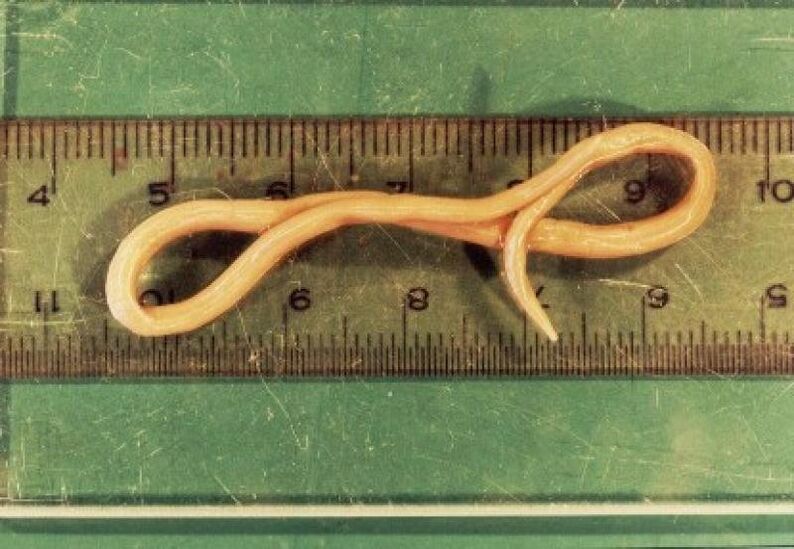 roundworm bizkarroi giza gorputza